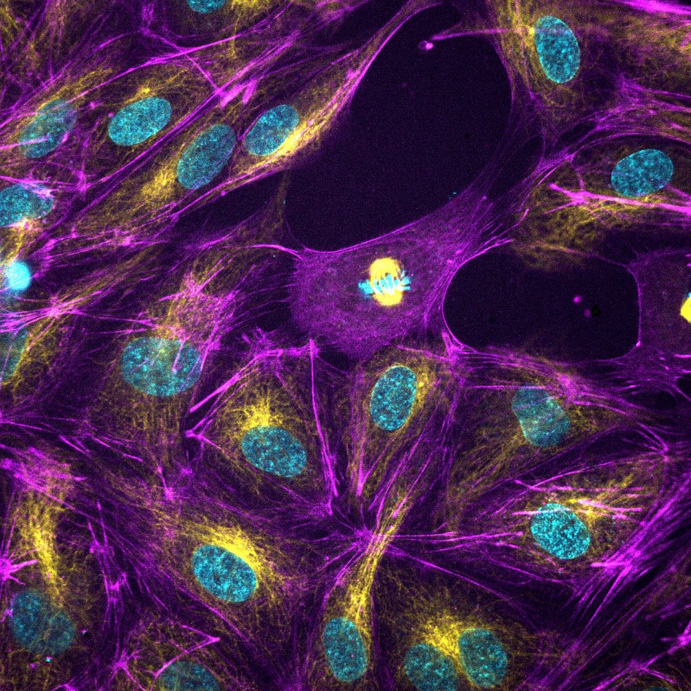 Confocal impression